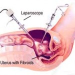 laparascope-images(1)